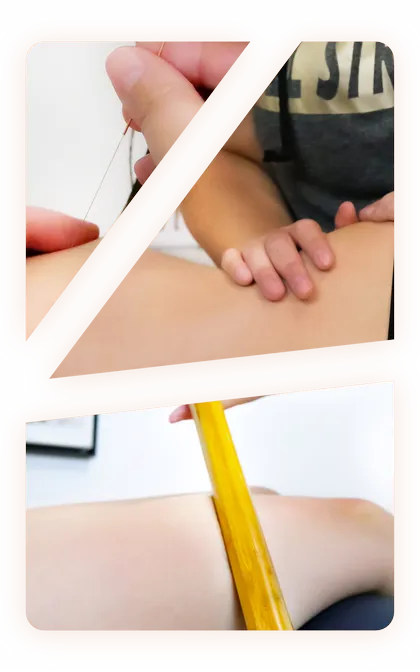 Collage aus drei Behandlungen: Setzen einer Akupunkturnadel, chiropraktische Mobilisation des Beins und Thai-Bambus-Massage